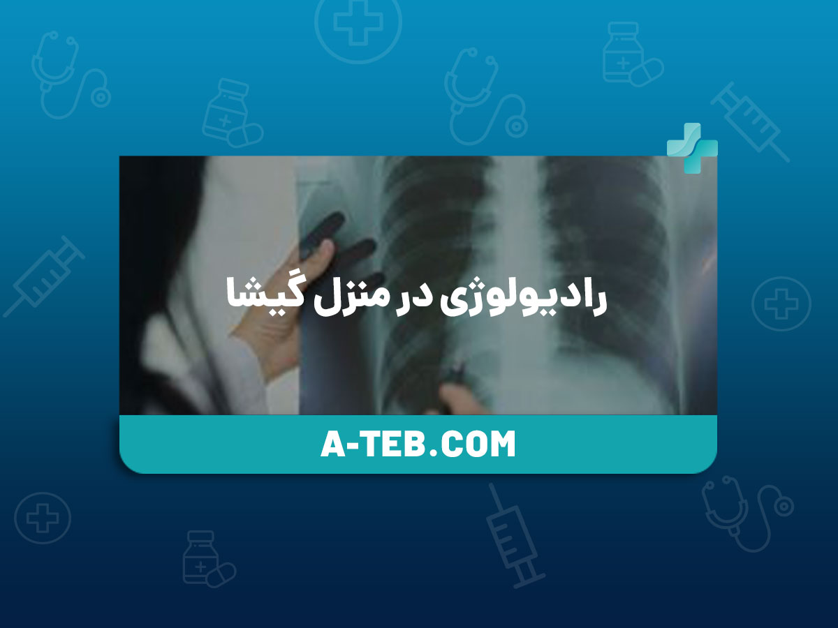 رادیولوژی در منزل گیشا