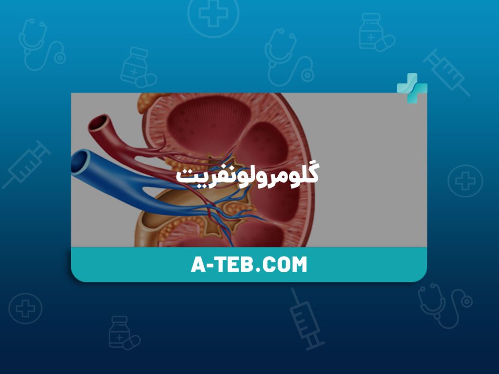 گلومرولونفریت