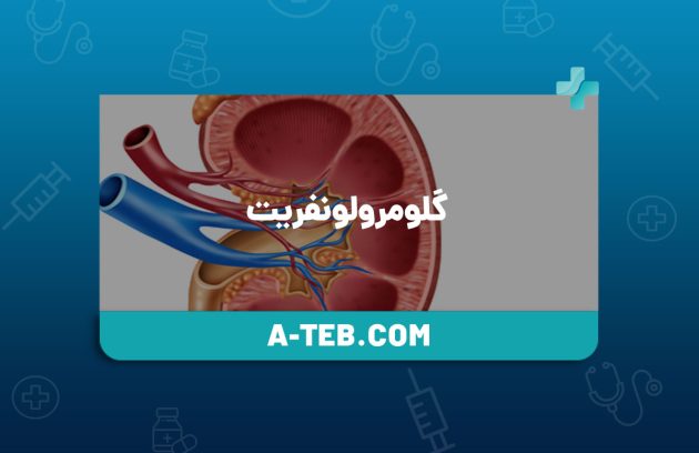 گلومرولونفریت