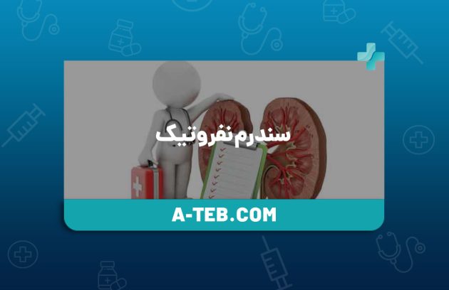 سندرم نفروتیک