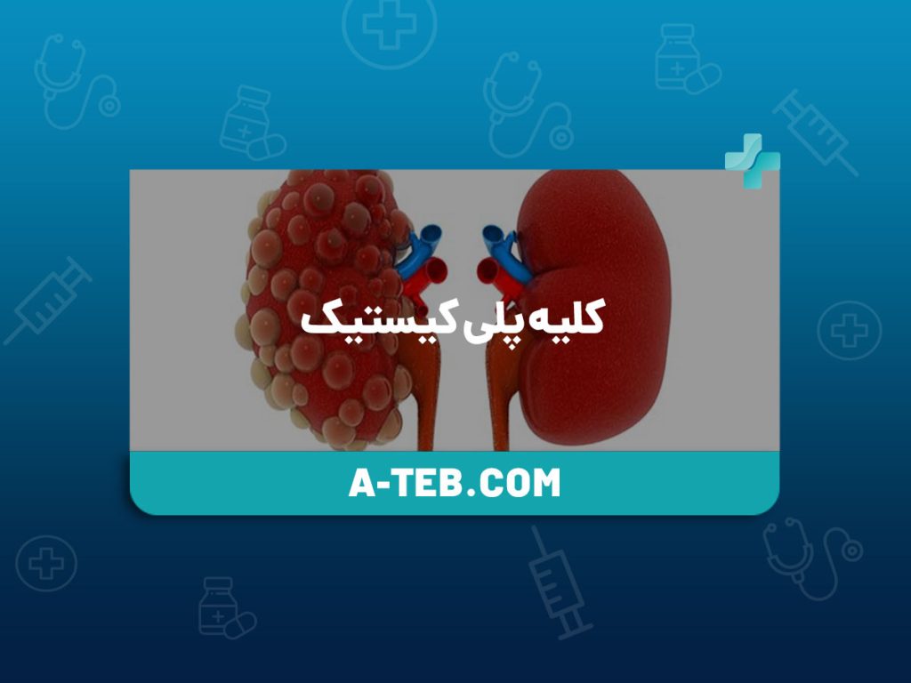 کلیه پلی کیستیک