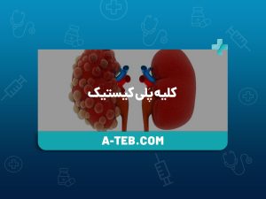 کلیه پلی کیستیک