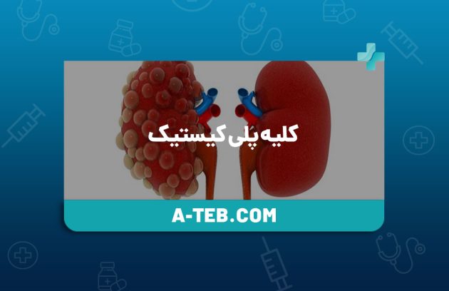 کلیه پلی‌ کیستیک