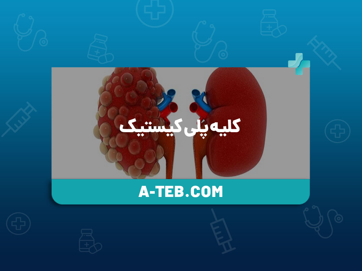 کلیه پلی کیستیک