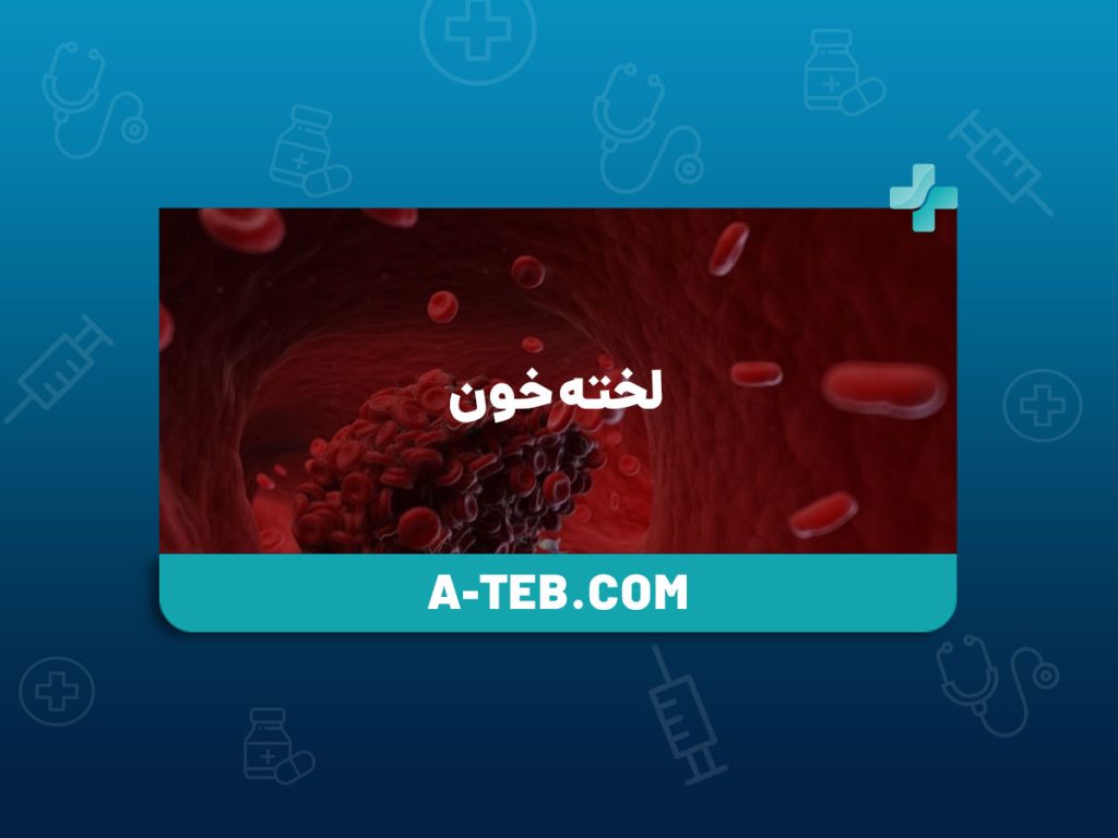 لخته خون