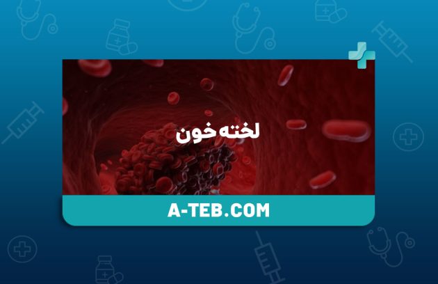 لخته خون