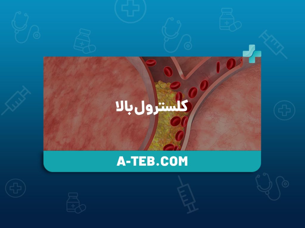 کلسترول بالا
