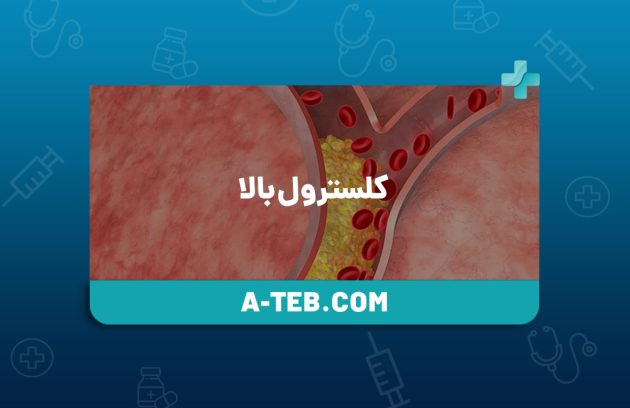 کلسترول بالا