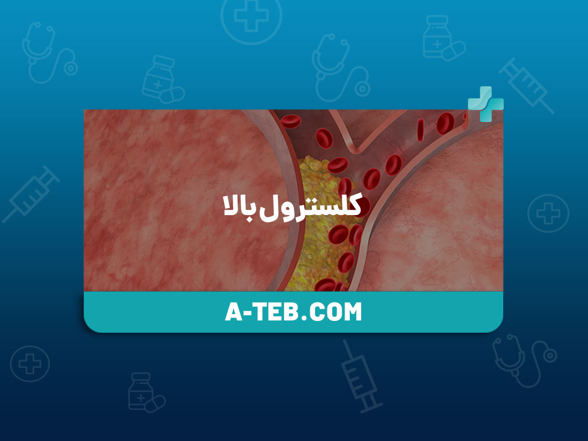 کلسترول بالا