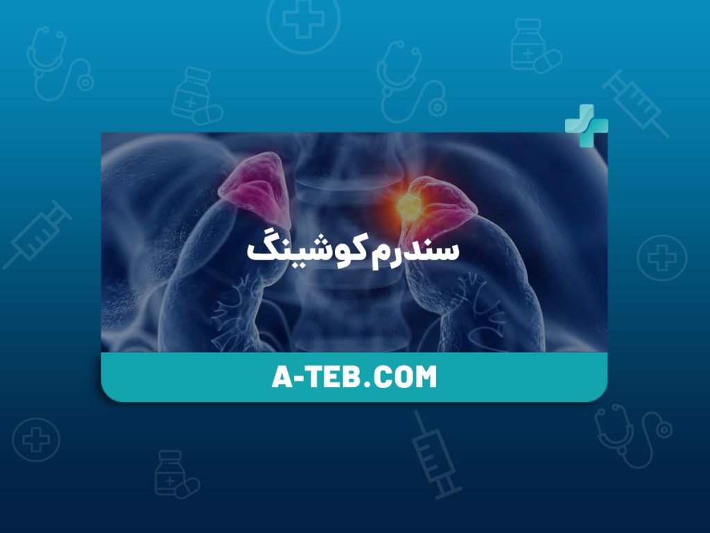 سندرم کوشینگ