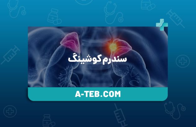 سندرم کوشینگ