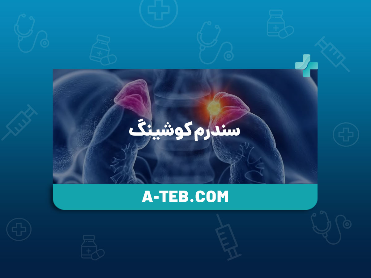 سندرم کوشینگ