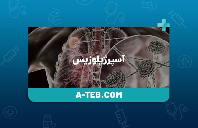 آسپرژیلوزیس