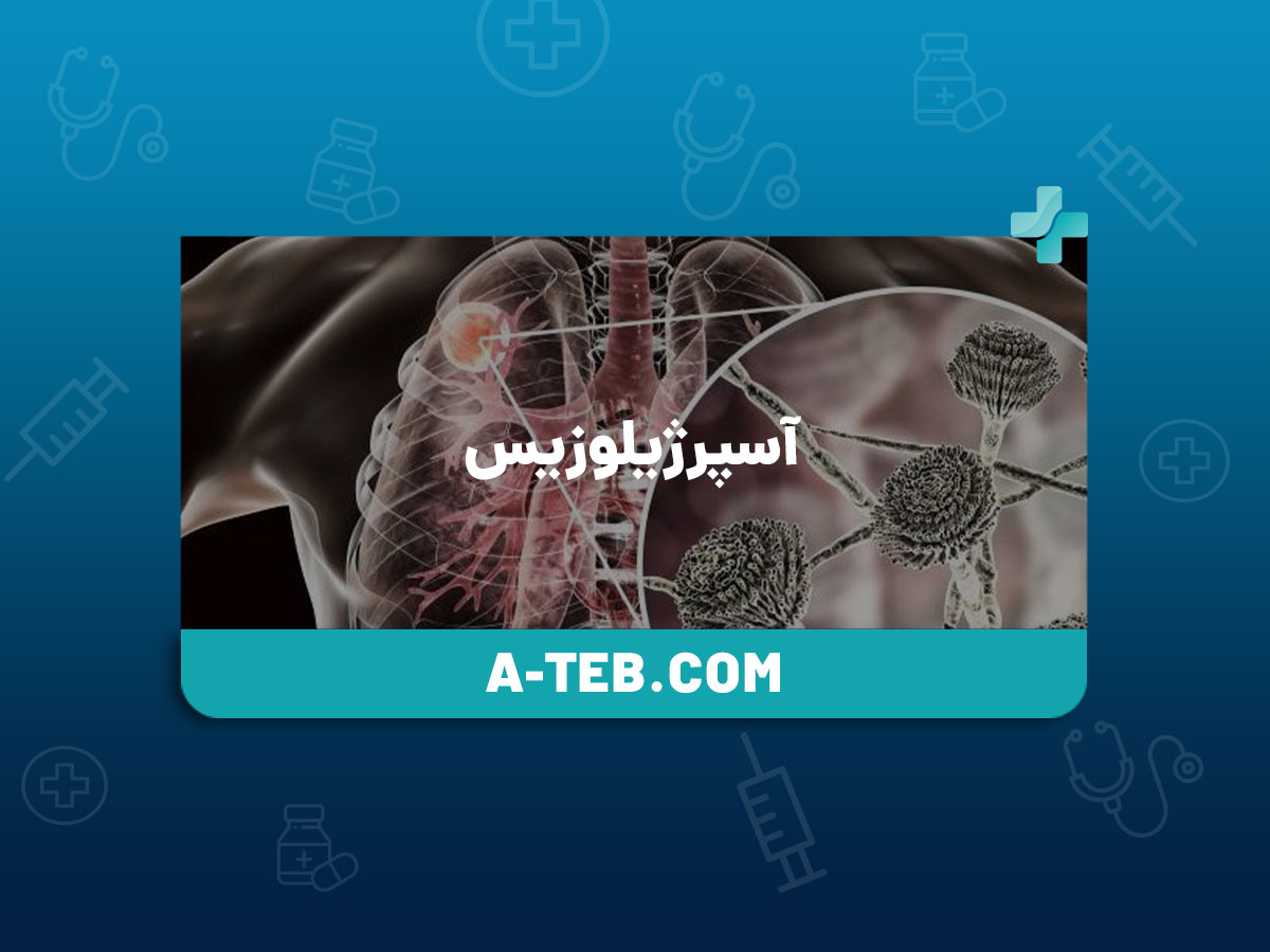 آسپرژیلوزیس