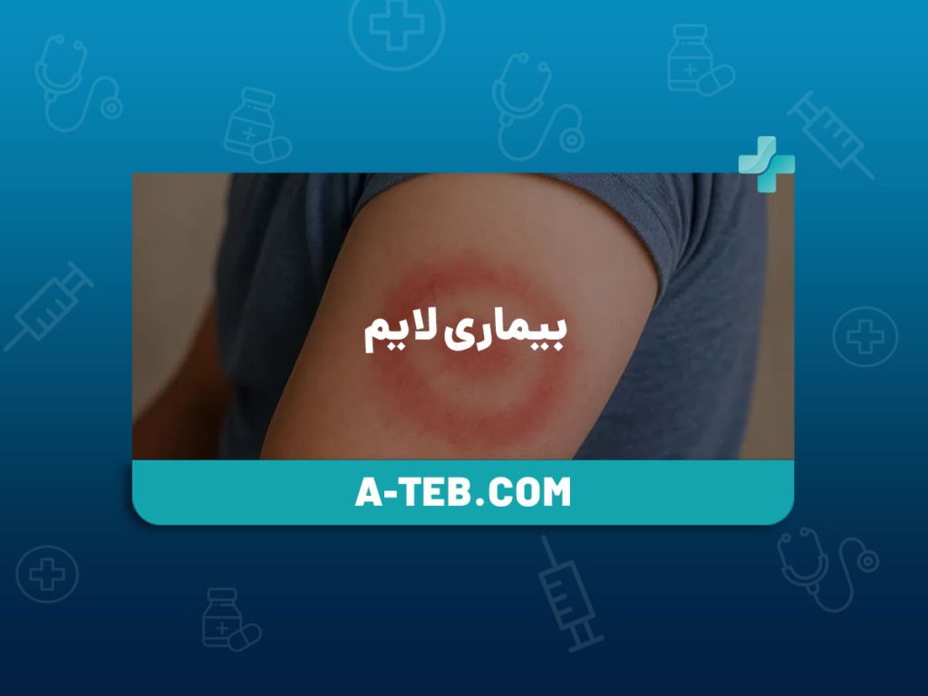 بیماری لایم