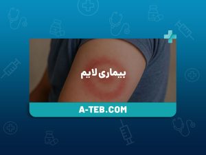 بیماری لایم