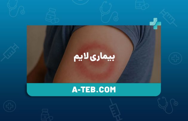 بیماری لایم