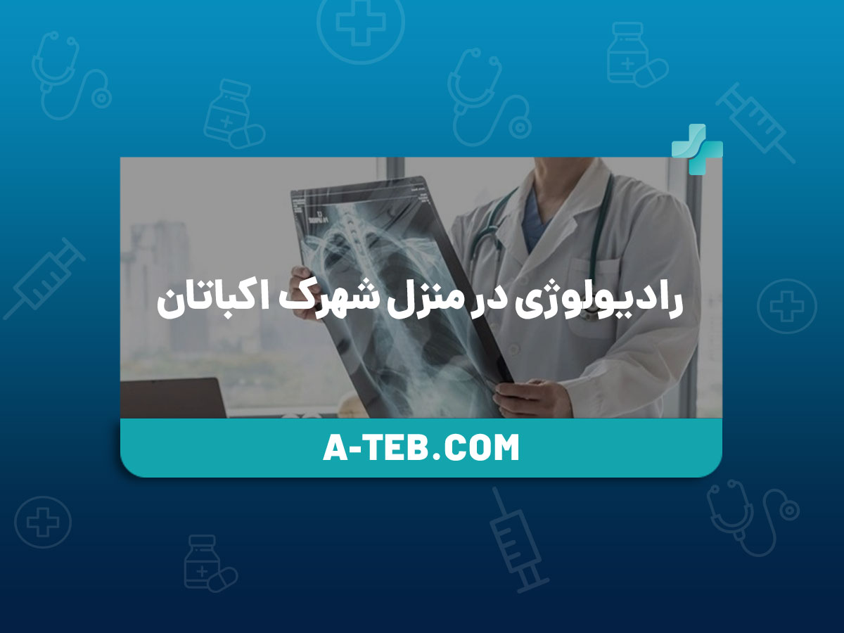 رادیولوژی در منزل شهرک اکباتان
