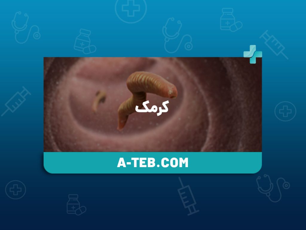کرمک