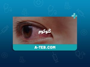 گلوکوم