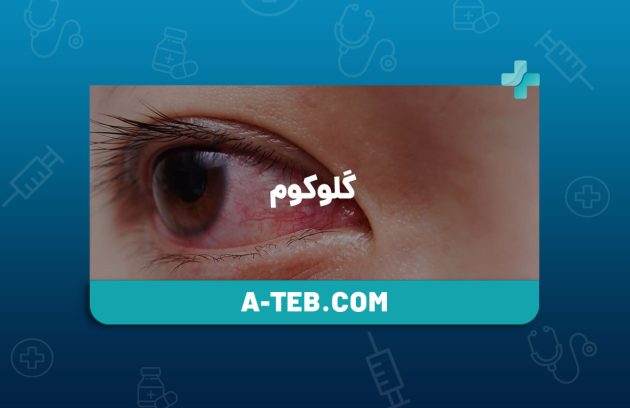 گلوکوم
