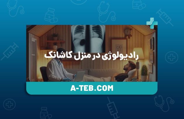 رادیولوژی در منزل کاشانک