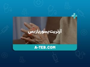 آرتریت پسوریازیس