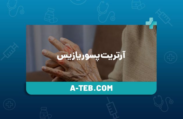 آرتریت پسوریازیس