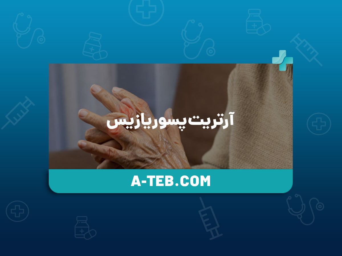 آرتریت پسوریازیس