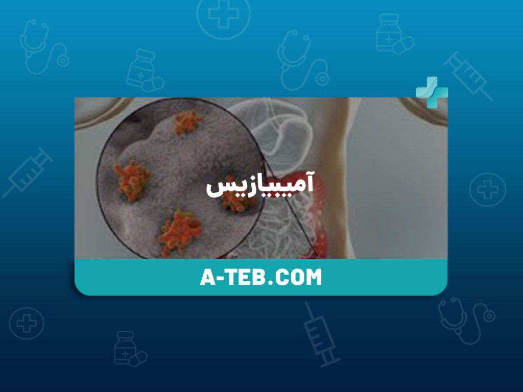 آمیبیازیس