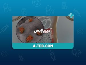 آمیبیازیس