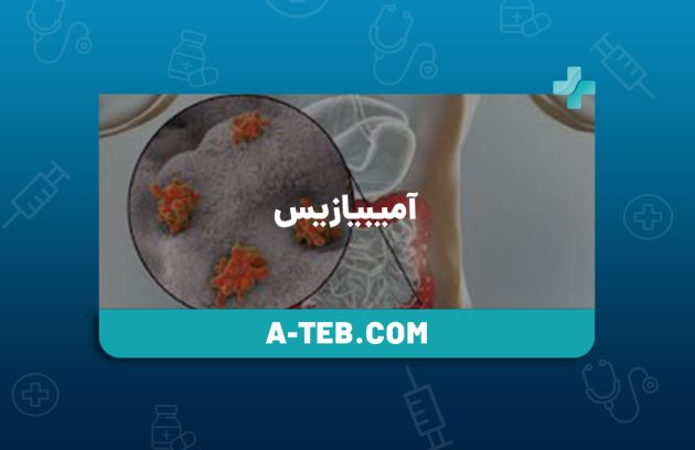 آمیبیازیس