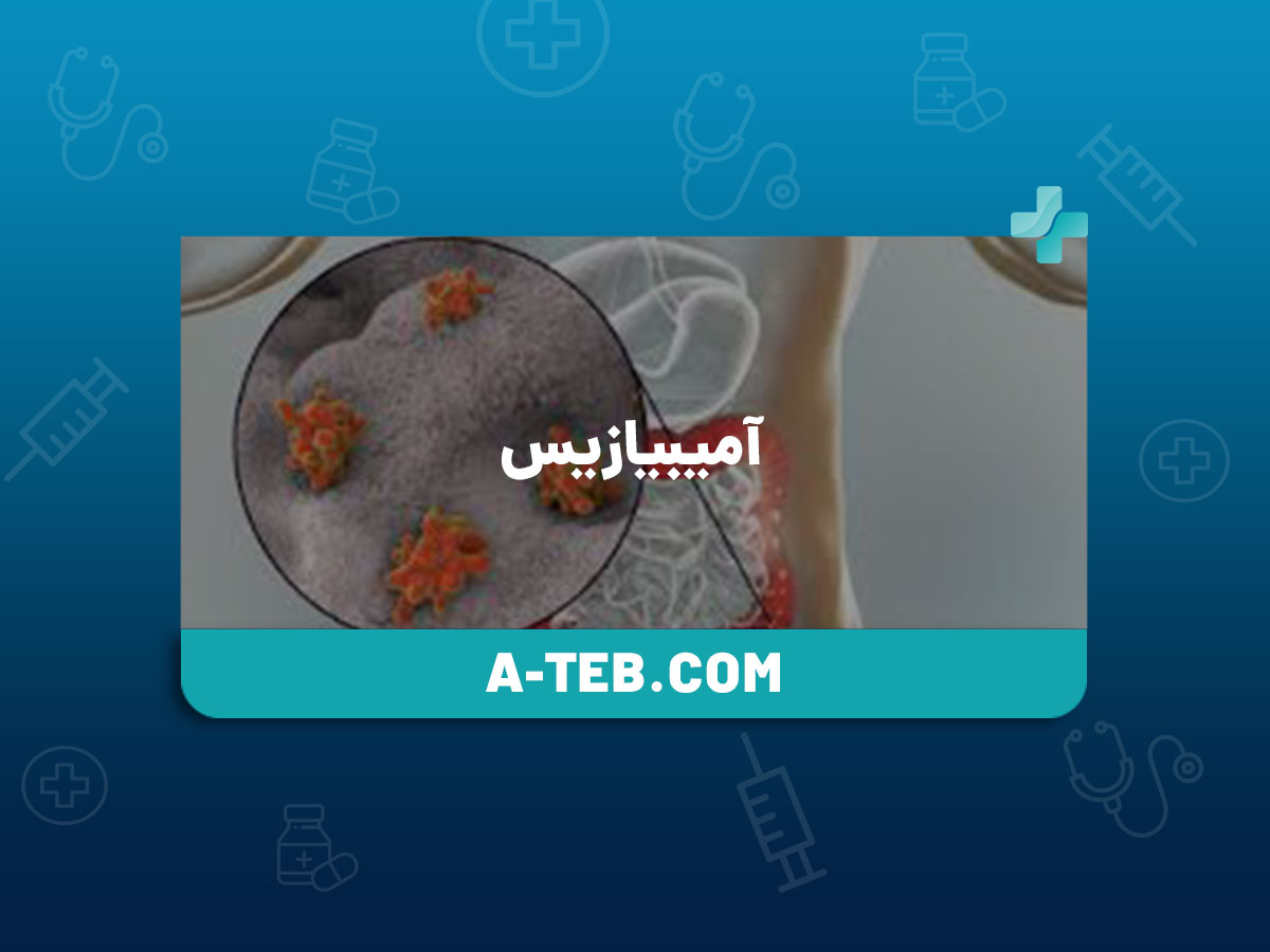 آمیبیازیس