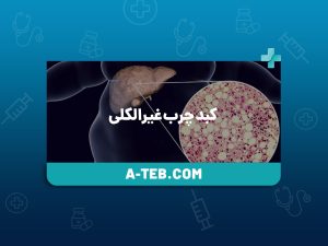 کبد چرب غیرالکلی