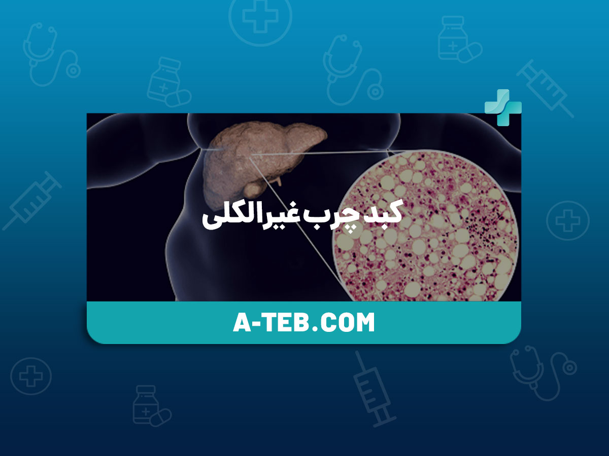 کبد چرب غیرالکلی