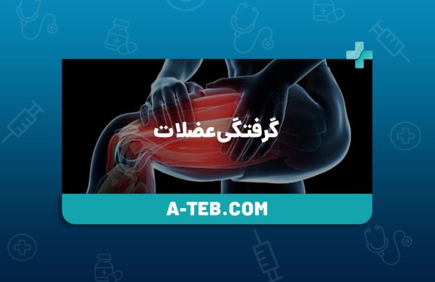 گرفتگی عضلات