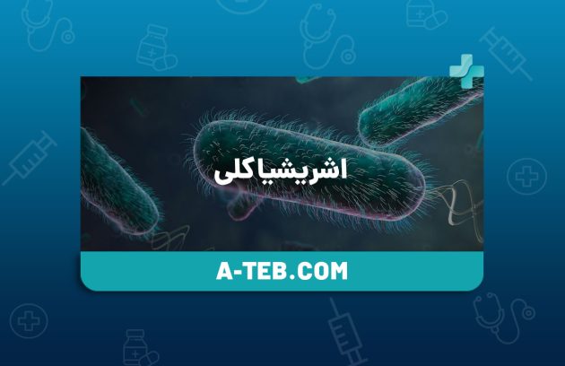 اشریشیا کلی