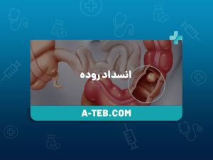 انسداد روده