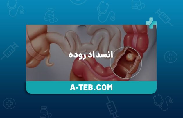 انسداد روده