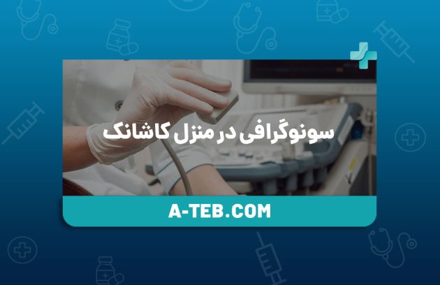 سونوگرافی در منزل کاشانک
