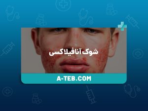 شوک آنافیلاکسی