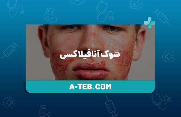 شوک آنافیلاکسی