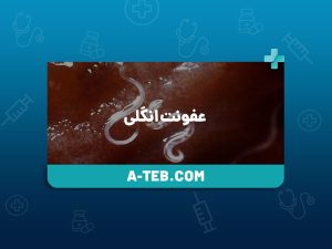 عفونت انگلی