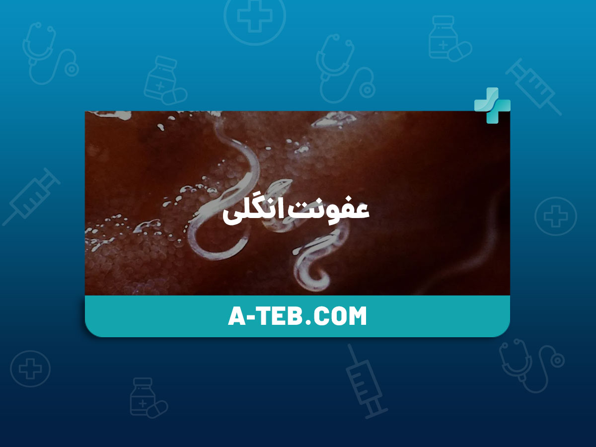 عفونت انگلی
