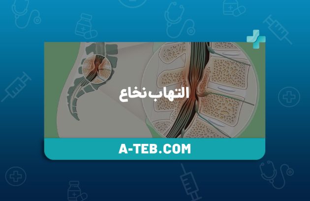 التهاب نخاع