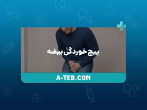 پیچ خوردگی بیضه