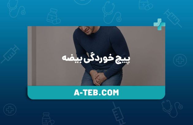 پیچ خوردگی بیضه