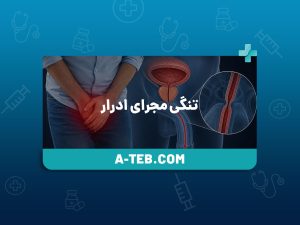 تنگی مجرای ادرار