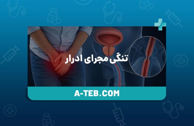 تنگی مجرای ادرار