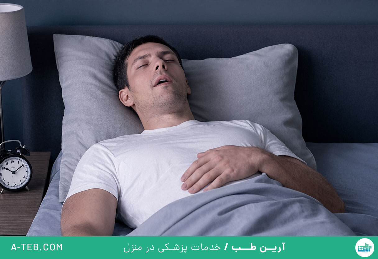 آپنه خواب